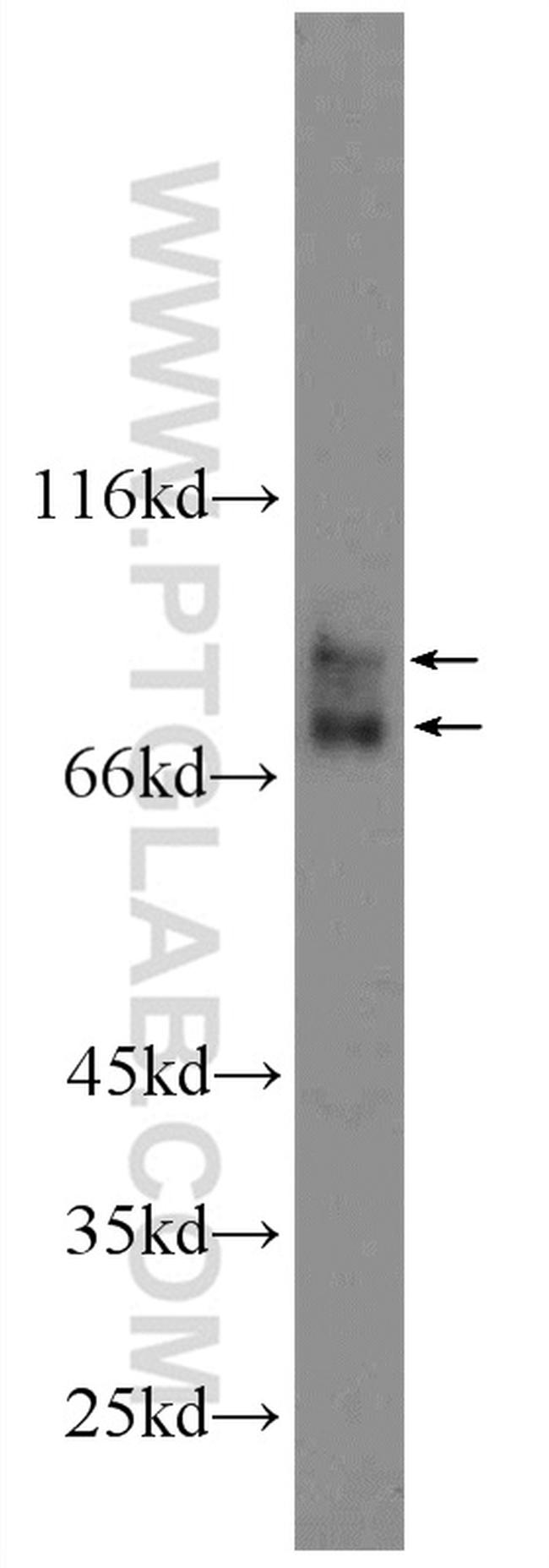 ACSL4/FACL4 Antibody in Western Blot (WB)