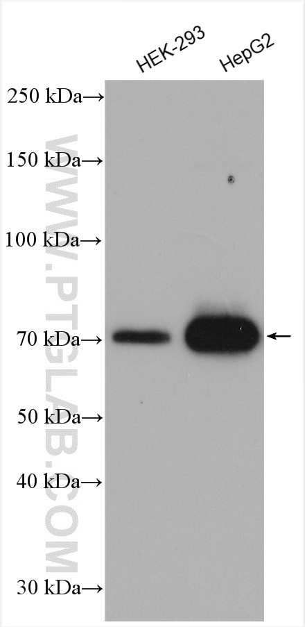 ACSL4/FACL4 Antibody in Western Blot (WB)