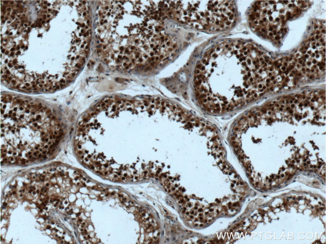 Casein Kinase 2 beta Antibody in Immunohistochemistry (Paraffin) (IHC (P))