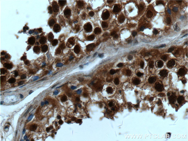 Casein Kinase 2 beta Antibody in Immunohistochemistry (Paraffin) (IHC (P))