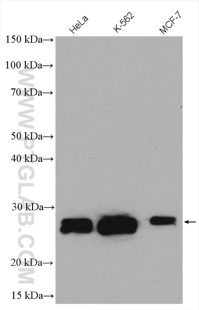 Casein Kinase 2 beta Antibody in Western Blot (WB)