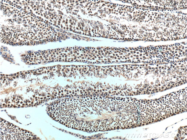 Casein Kinase 2 beta Antibody in Immunohistochemistry (Paraffin) (IHC (P))