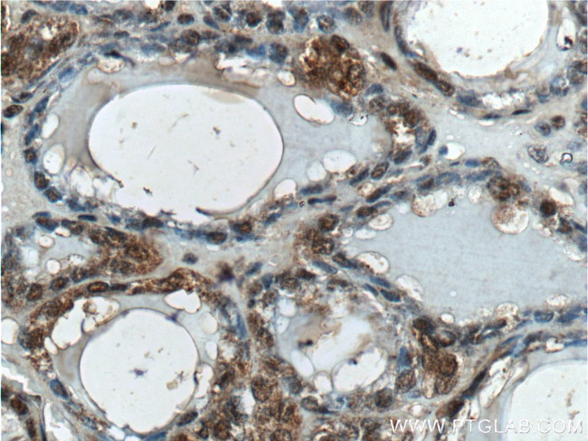 Casein Kinase 2 beta Antibody in Immunohistochemistry (Paraffin) (IHC (P))