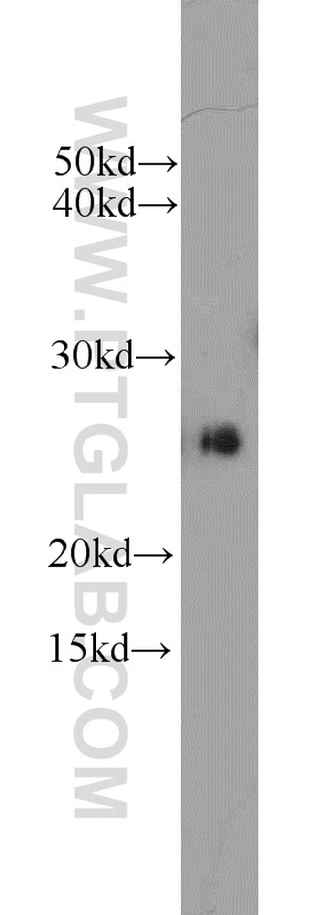 Casein Kinase 2 beta Antibody in Western Blot (WB)