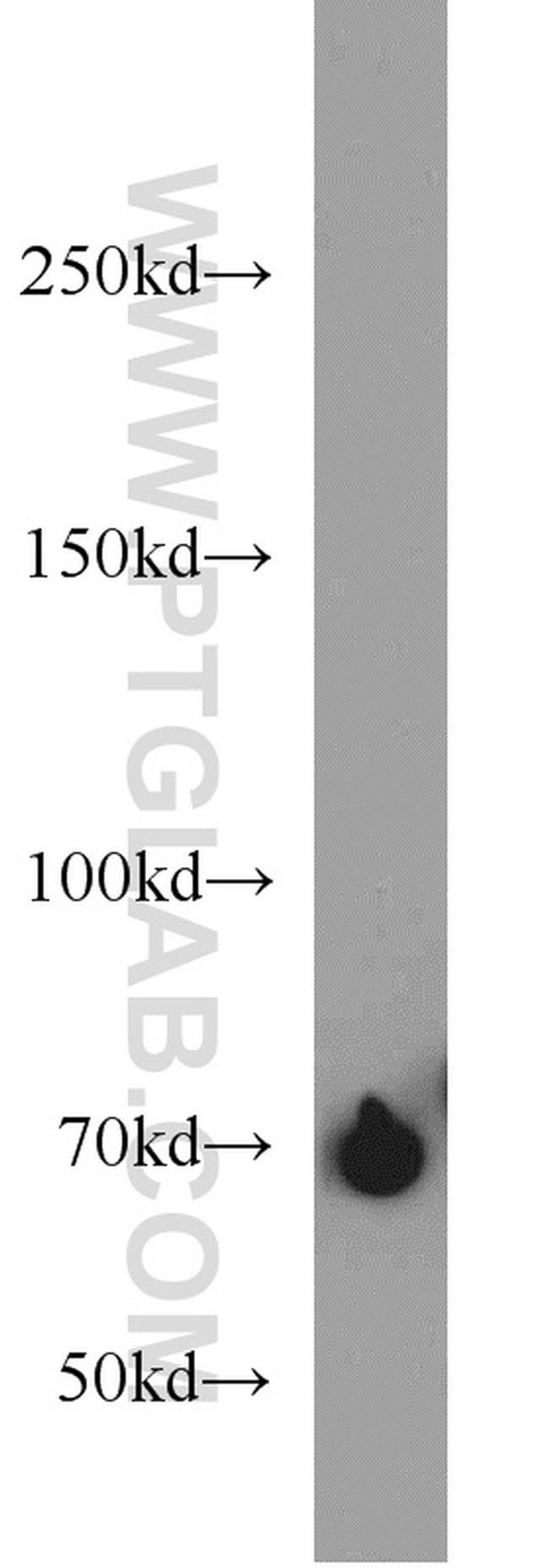 ADRA1B Antibody in Western Blot (WB)