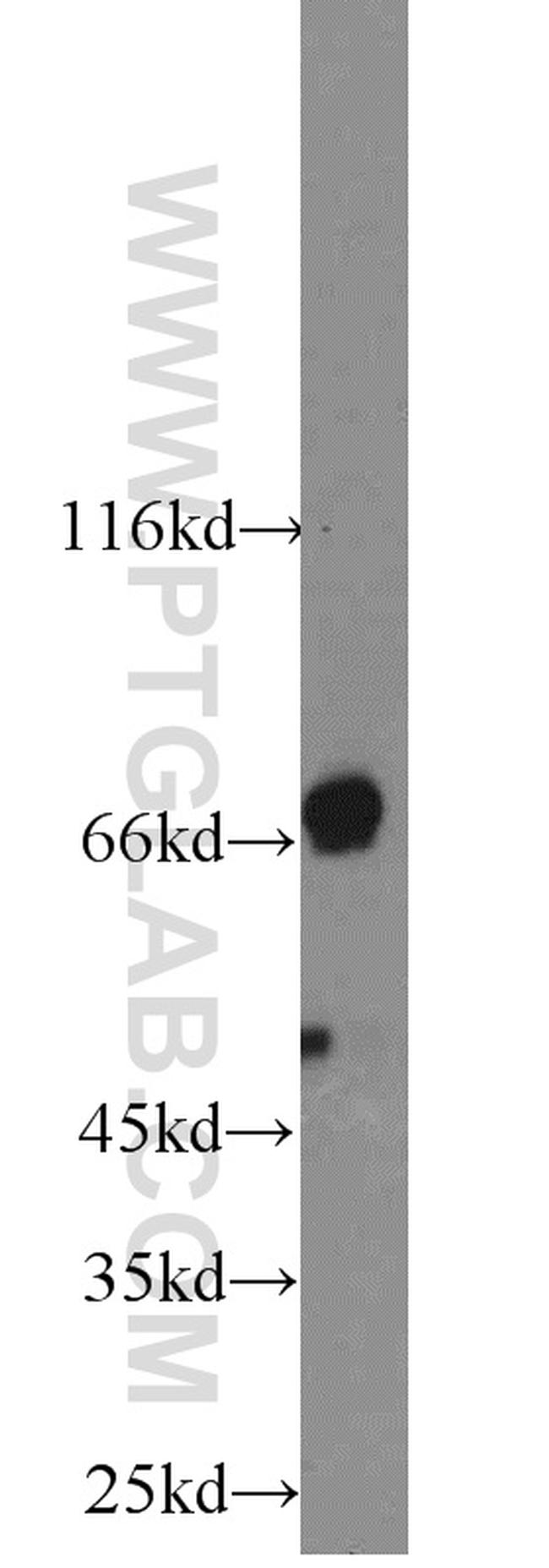 ADRA1B Antibody in Western Blot (WB)