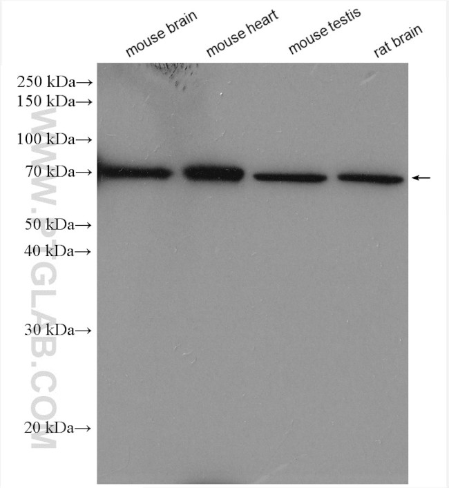 ADRA1B Antibody in Western Blot (WB)