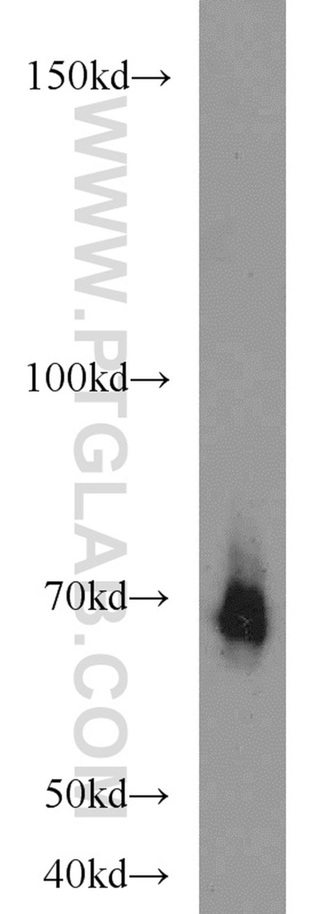 ADRA1B Antibody in Western Blot (WB)