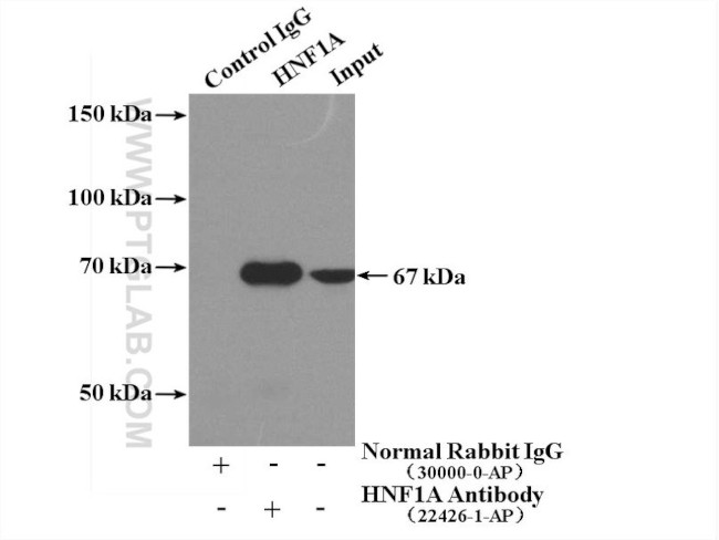 HNF1A Antibody in Immunoprecipitation (IP)