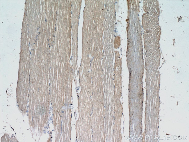 ABLIM2 Antibody in Immunohistochemistry (Paraffin) (IHC (P))