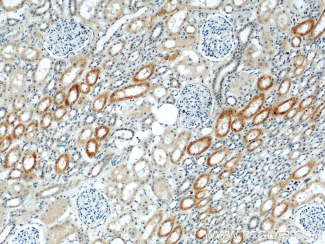 ABLIM2 Antibody in Immunohistochemistry (Paraffin) (IHC (P))