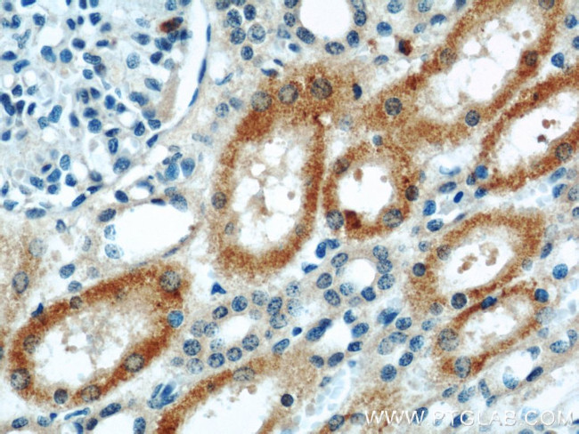 ABLIM2 Antibody in Immunohistochemistry (Paraffin) (IHC (P))