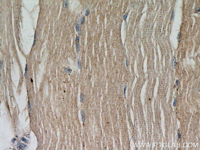 ABLIM2 Antibody in Immunohistochemistry (Paraffin) (IHC (P))