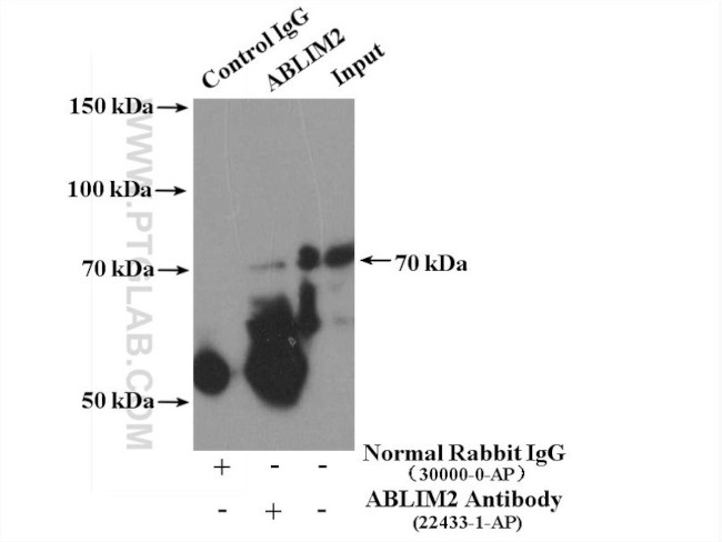 ABLIM2 Antibody in Immunoprecipitation (IP)