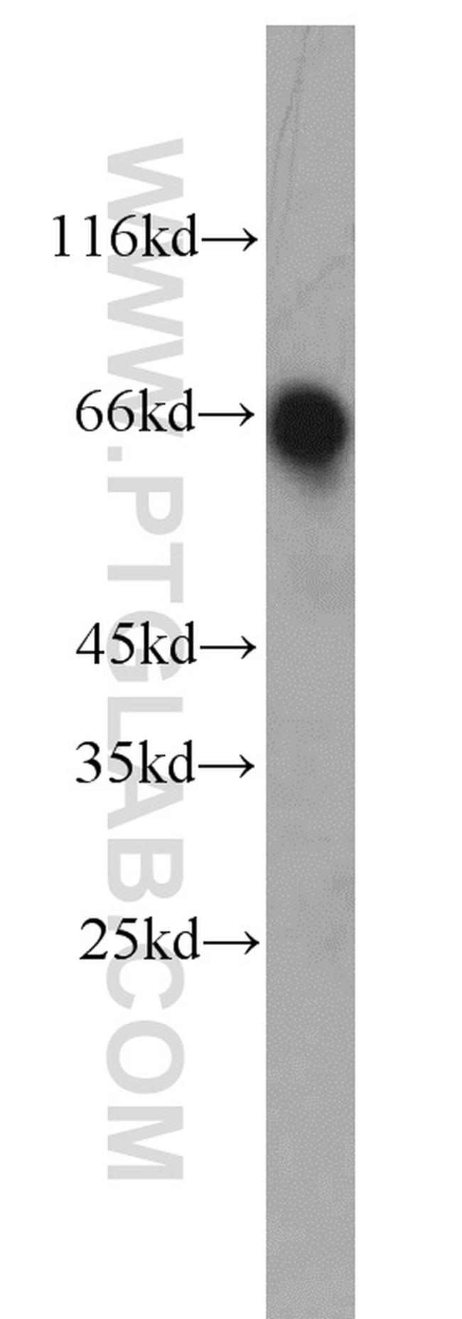 ABLIM2 Antibody in Western Blot (WB)