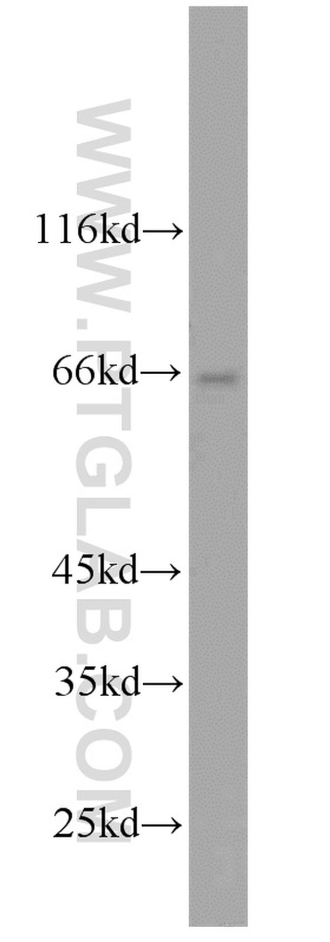 ABLIM2 Antibody in Western Blot (WB)