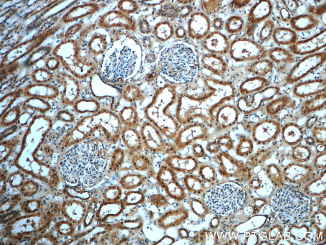 ERBB2IP Antibody in Immunohistochemistry (Paraffin) (IHC (P))