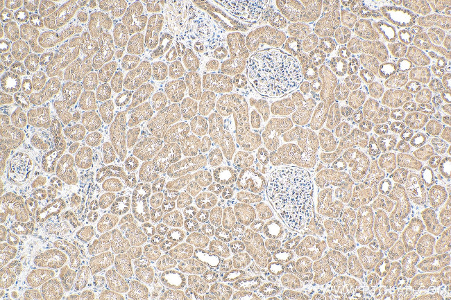 ERBB2IP Antibody in Immunohistochemistry (Paraffin) (IHC (P))