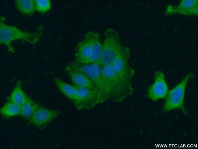 ERBB2IP Antibody in Immunocytochemistry (ICC/IF)