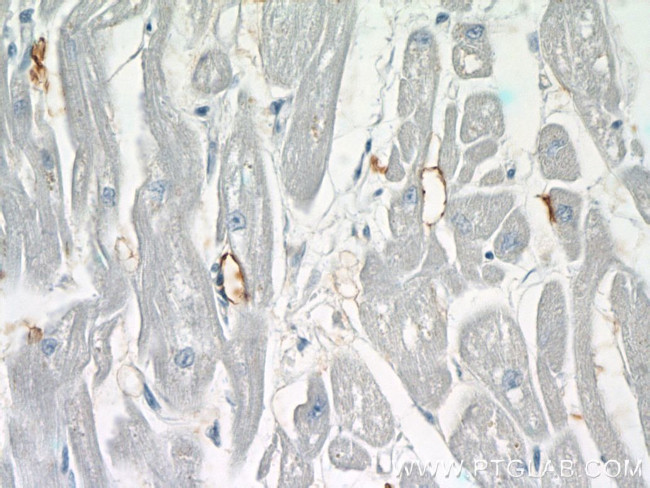 ERBB2IP Antibody in Immunohistochemistry (Paraffin) (IHC (P))