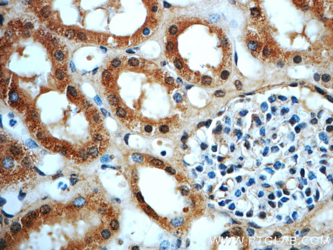 ERBB2IP Antibody in Immunohistochemistry (Paraffin) (IHC (P))