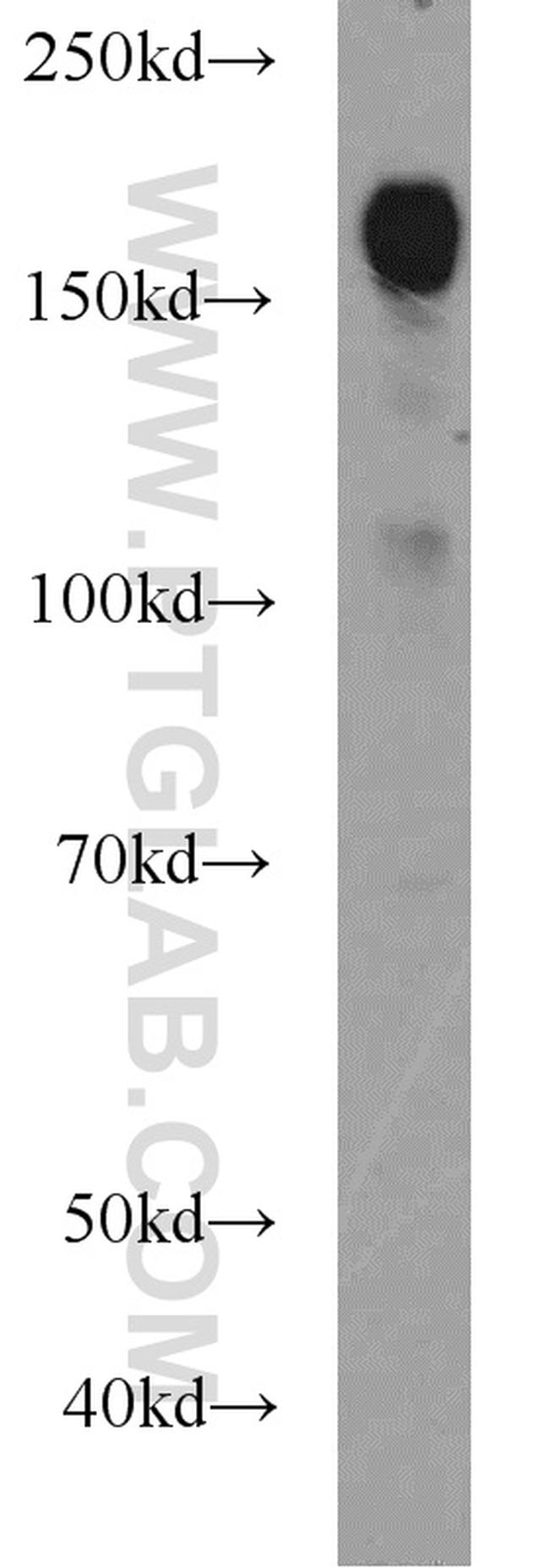 ERBB2IP Antibody in Western Blot (WB)