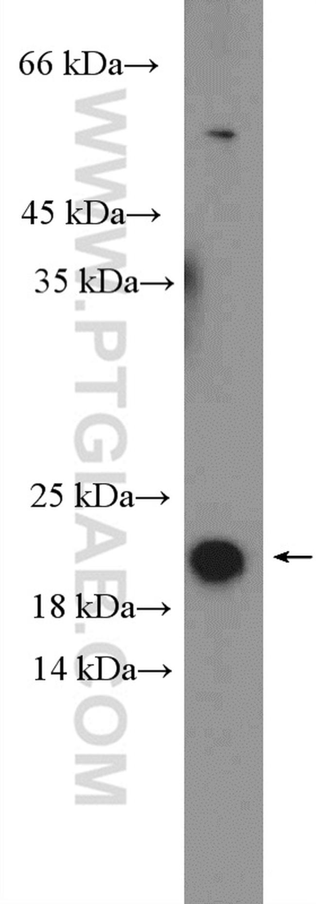 GABARAP Antibody in Western Blot (WB)