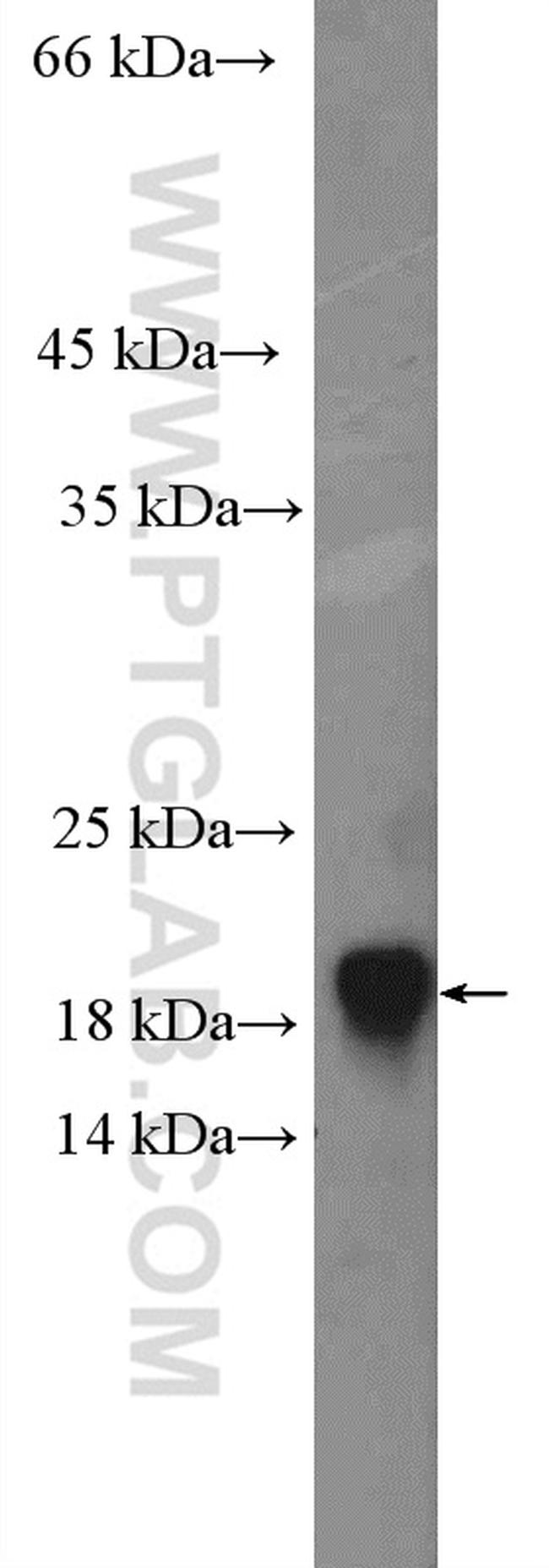 GABARAP Antibody in Western Blot (WB)