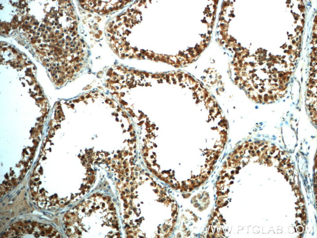 LARG Antibody in Immunohistochemistry (Paraffin) (IHC (P))