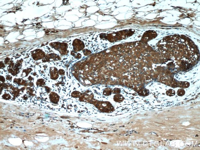 PKLR Antibody in Immunohistochemistry (Paraffin) (IHC (P))