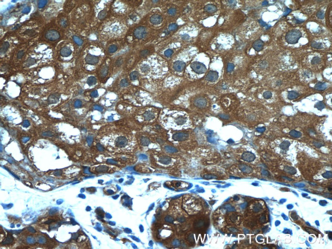 PKLR Antibody in Immunohistochemistry (Paraffin) (IHC (P))