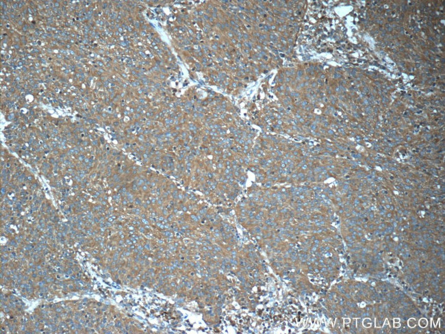 PKLR Antibody in Immunohistochemistry (Paraffin) (IHC (P))