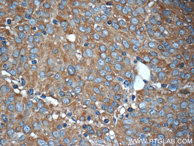 PKLR Antibody in Immunohistochemistry (Paraffin) (IHC (P))