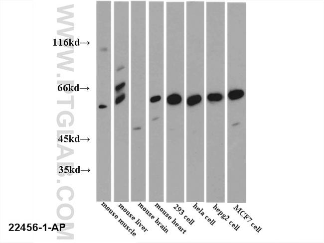 PKLR Antibody in Western Blot (WB)