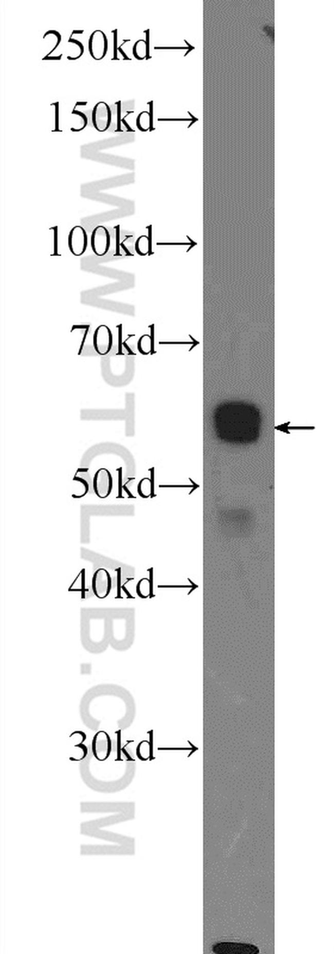 PKLR Antibody in Western Blot (WB)