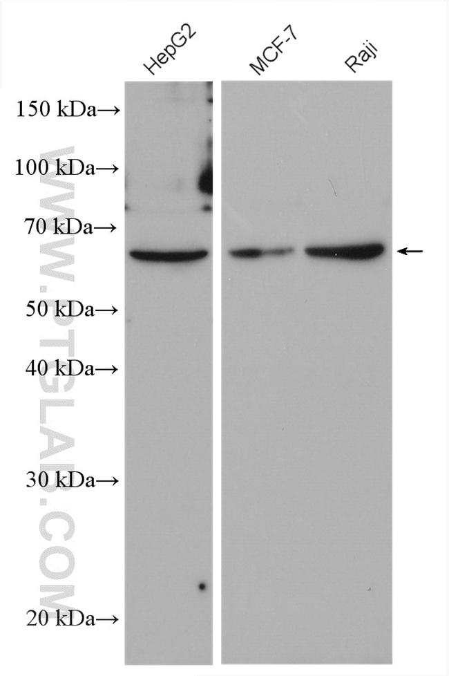 PKLR Antibody in Western Blot (WB)