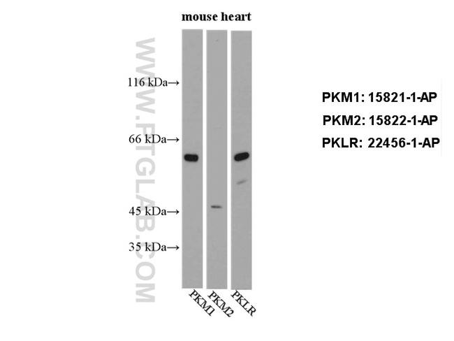 PKLR Antibody in Western Blot (WB)