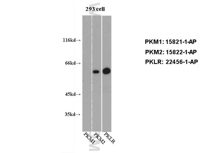 PKLR Antibody in Western Blot (WB)