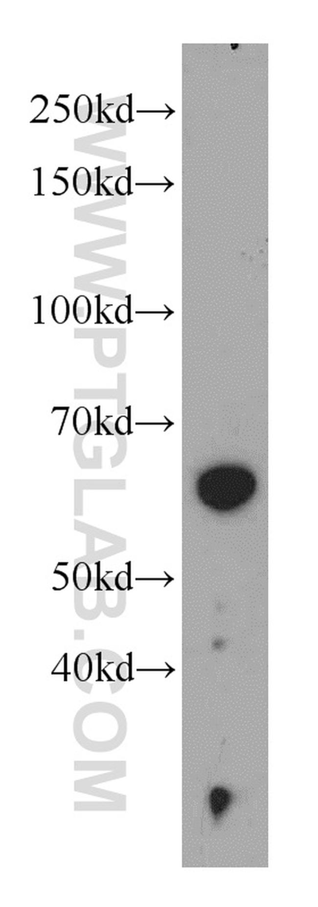 PKLR Antibody in Western Blot (WB)