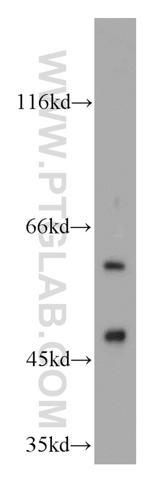 PKLR Antibody in Western Blot (WB)