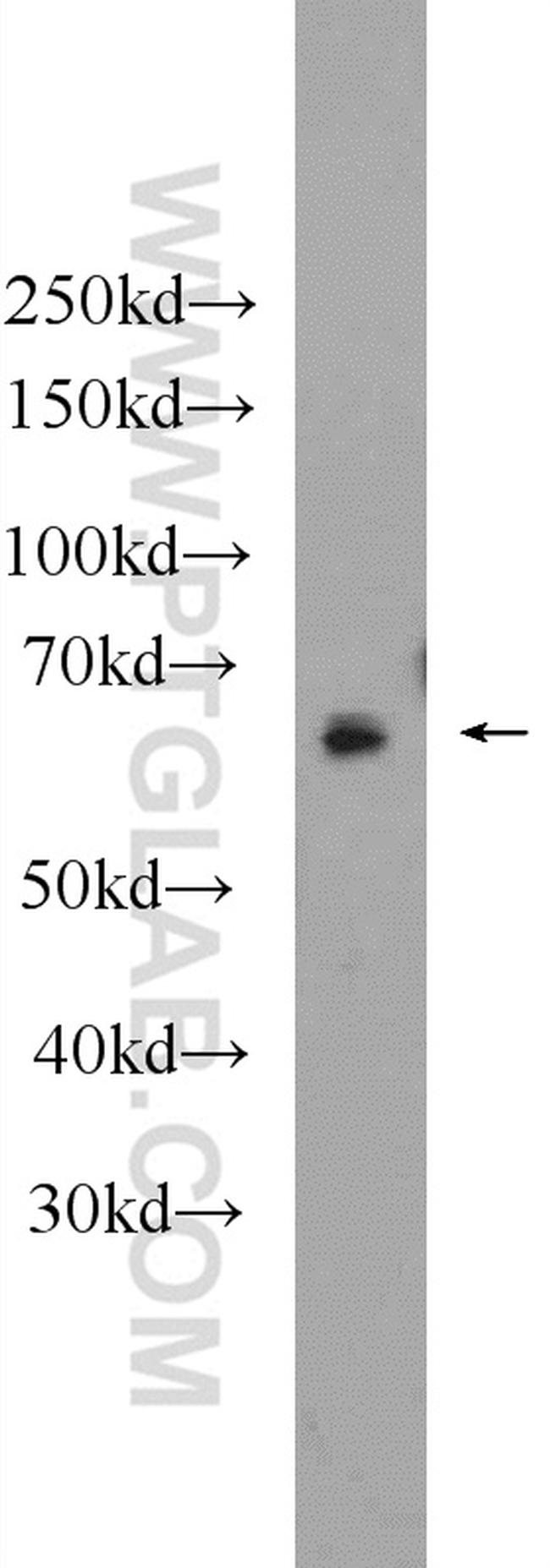 NR5A2 Antibody in Western Blot (WB)