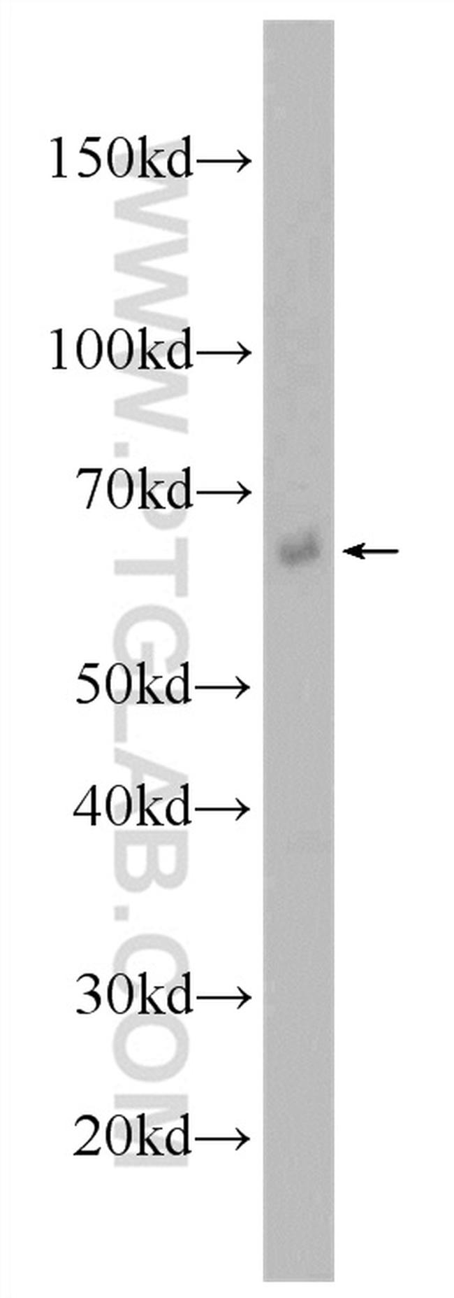 NR5A2 Antibody in Western Blot (WB)