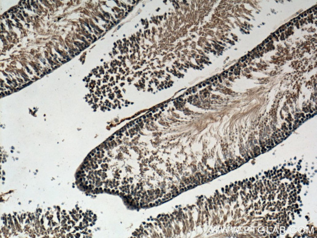 GNRHR Antibody in Immunohistochemistry (Paraffin) (IHC (P))