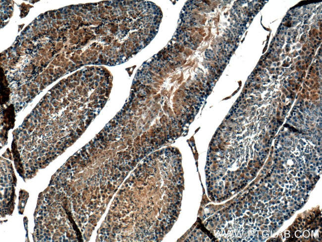 GNRHR Antibody in Immunohistochemistry (Paraffin) (IHC (P))