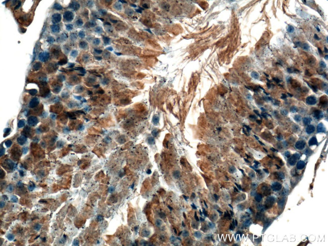 GNRHR Antibody in Immunohistochemistry (Paraffin) (IHC (P))