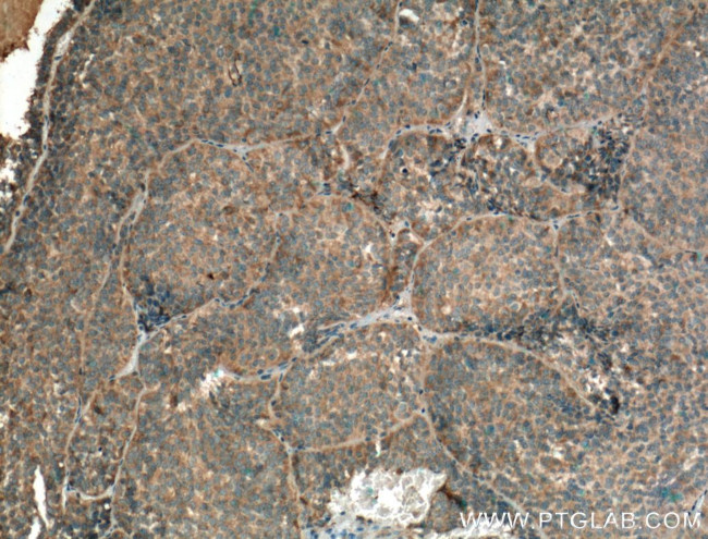 GNRHR Antibody in Immunohistochemistry (Paraffin) (IHC (P))