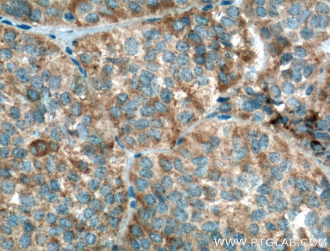 GNRHR Antibody in Immunohistochemistry (Paraffin) (IHC (P))