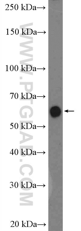 GNRHR Antibody in Western Blot (WB)