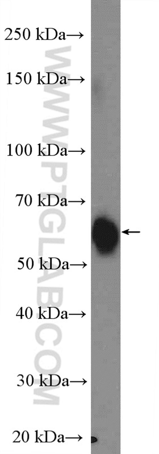 GNRHR Antibody in Western Blot (WB)