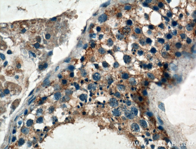 GNRHR Antibody in Immunohistochemistry (Paraffin) (IHC (P))